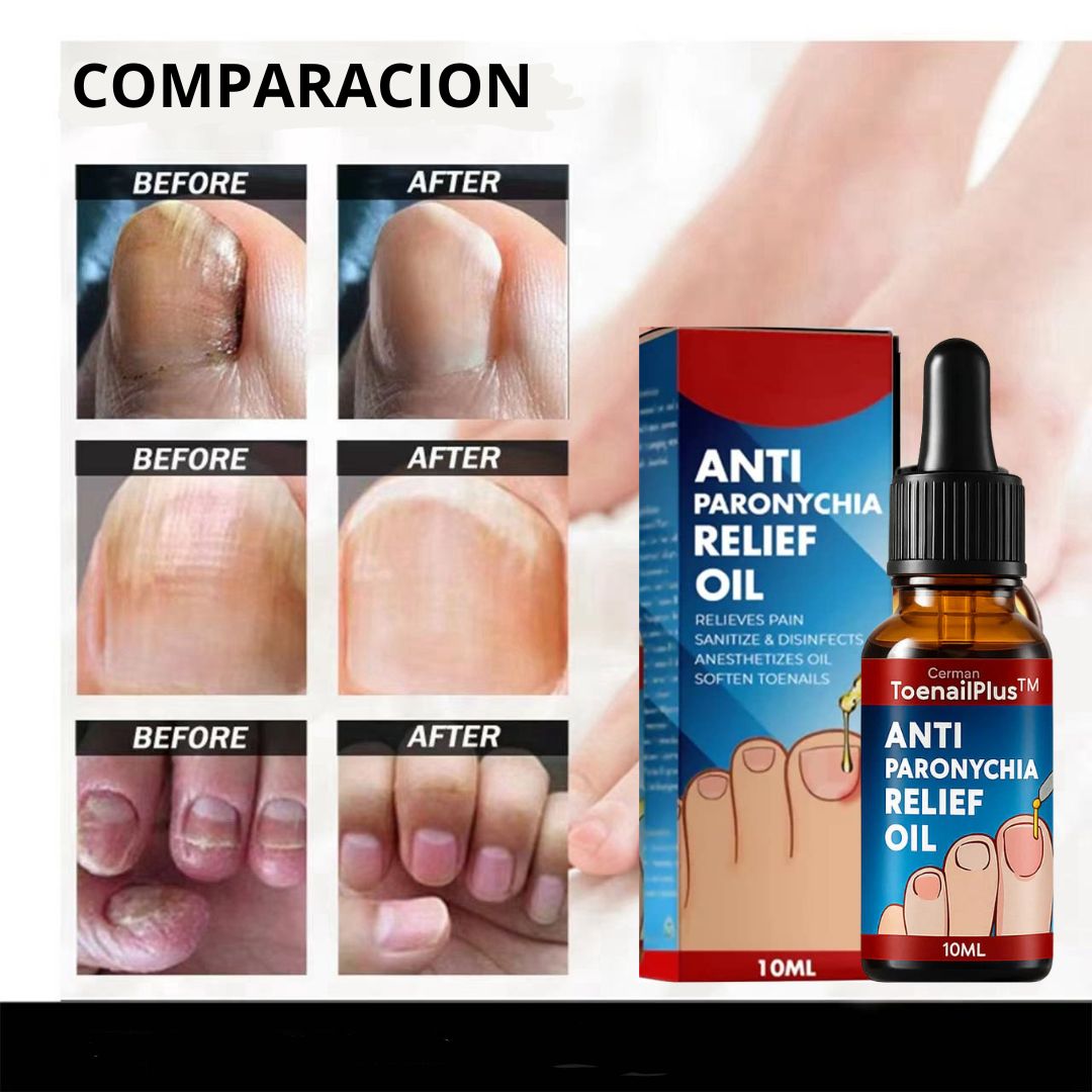 Aceite Restaurador Premium para Uñas 2 X 1 APROVECHA!