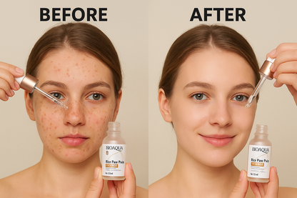DUO DE BIOAQUA SERUM Y CONTORNO                                                                                         -                                                                                                  TE REGALAMOS EL CONTORNO DE OJOS