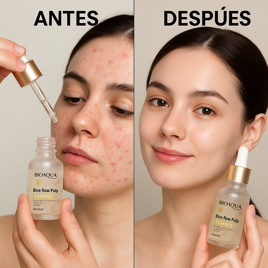DUO DE BIOAQUA SERUM Y CONTORNO                                                                                         -                                                                                                  TE REGALAMOS EL CONTORNO DE OJOS