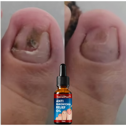 Aceite Restaurador Premium para Uñas Compra 1 te regalamos OTRO APROVECHA!