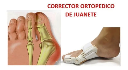 Corrector Flex para Juanete – 💸 Precio justo, sin pagar de más -                                                                                                                  PAGA 1 Y LLEVA 2 - SUPER PROMOCIÓN 😍✔️