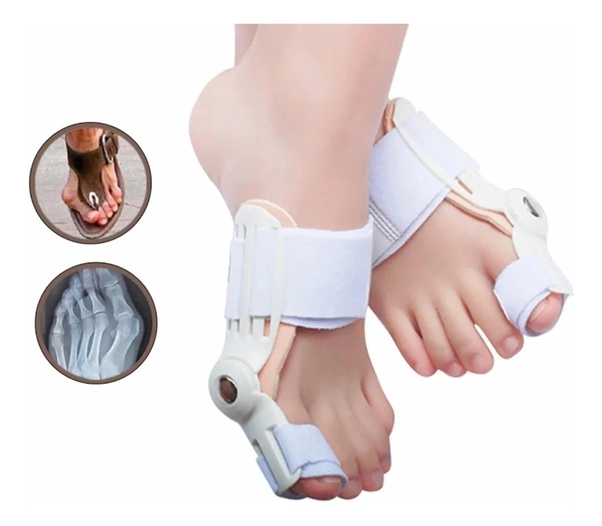 Corrector Flex para Juanete – 💸 Precio justo, sin pagar de más -                                                                                                                  PAGA 1 Y LLEVA 2 - SUPER PROMOCIÓN 😍✔️